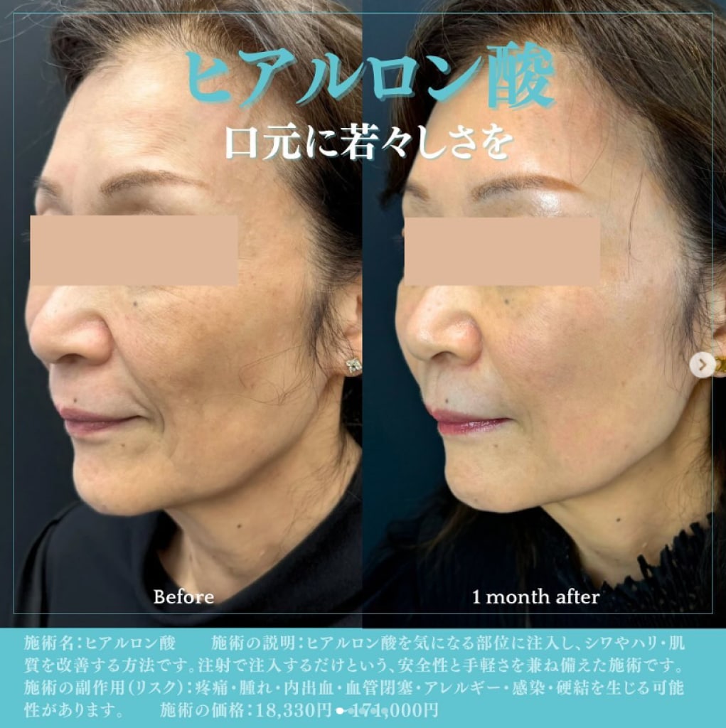 若返りの症例